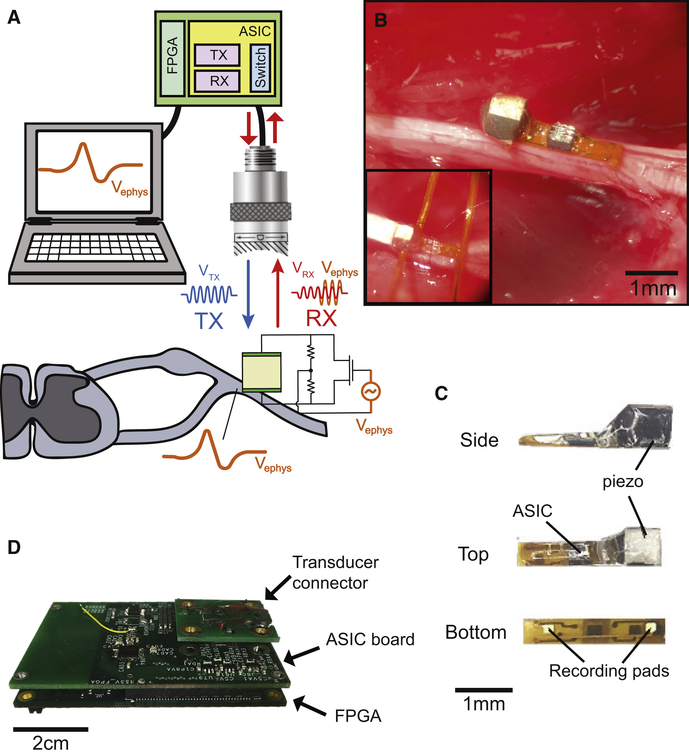 Wireless Recording in the Peripheral Nervous System with Ultrasonic Neural Dust