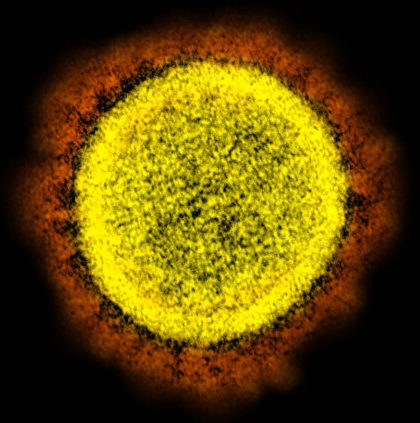 coronavirus_National Institute of Allergy and Infectious Diseases 