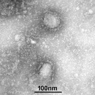 Coronavirus)_C-Tan-nCov_Wuhan_strain_01-20200123104509