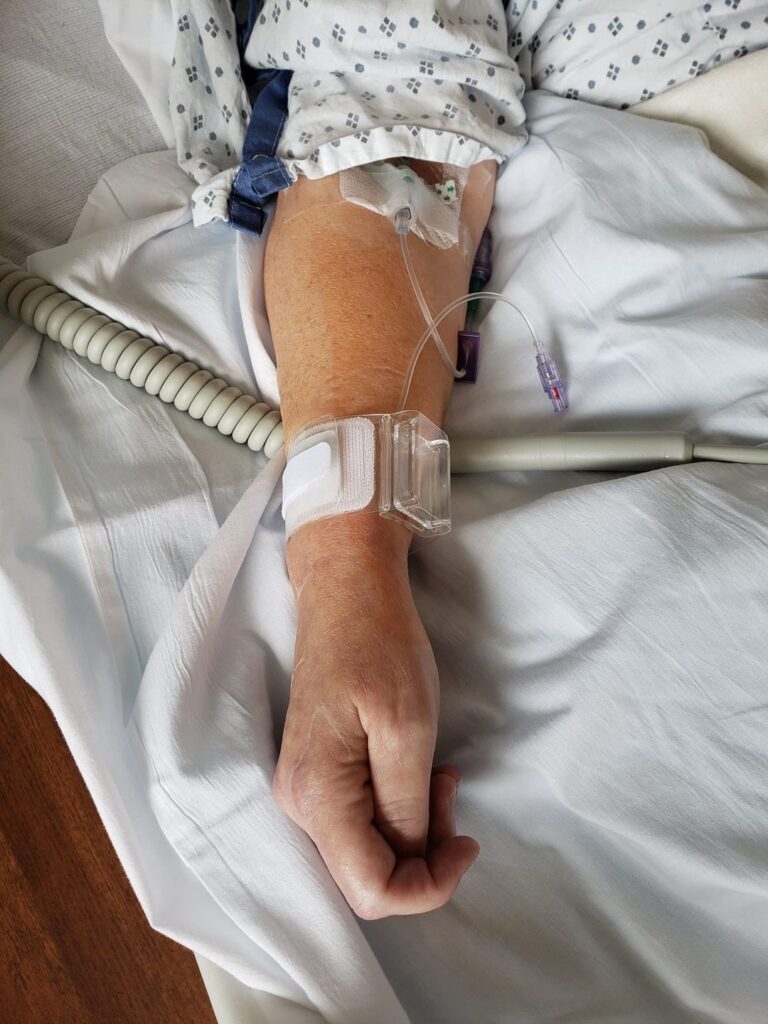 Ceredwyn arm after heart catheterization 2023 August